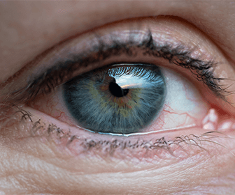 cirugia-de-retina-con-laser-puede-presentar